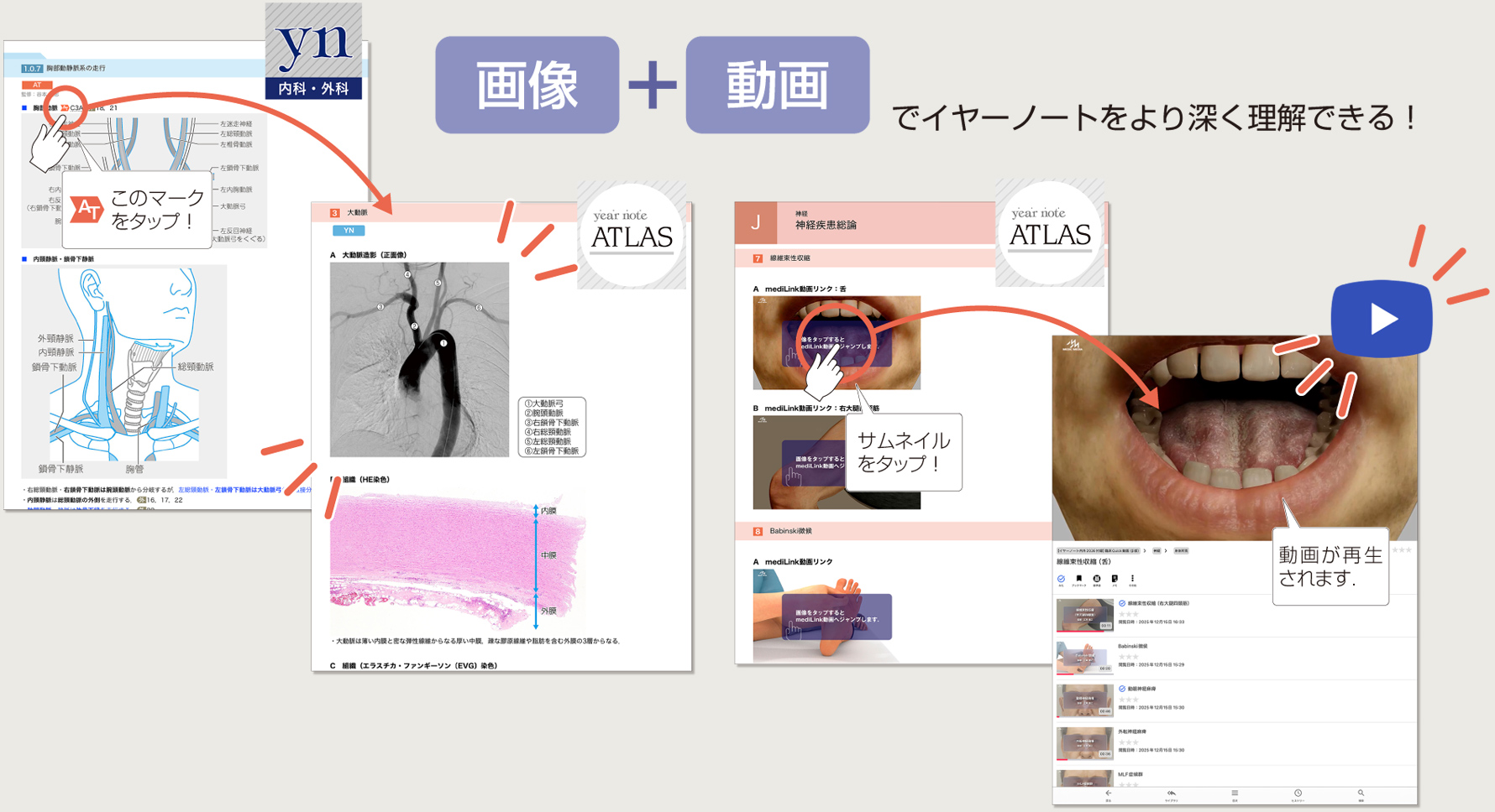 画像+動画でイヤーノートをより深く理解できる！