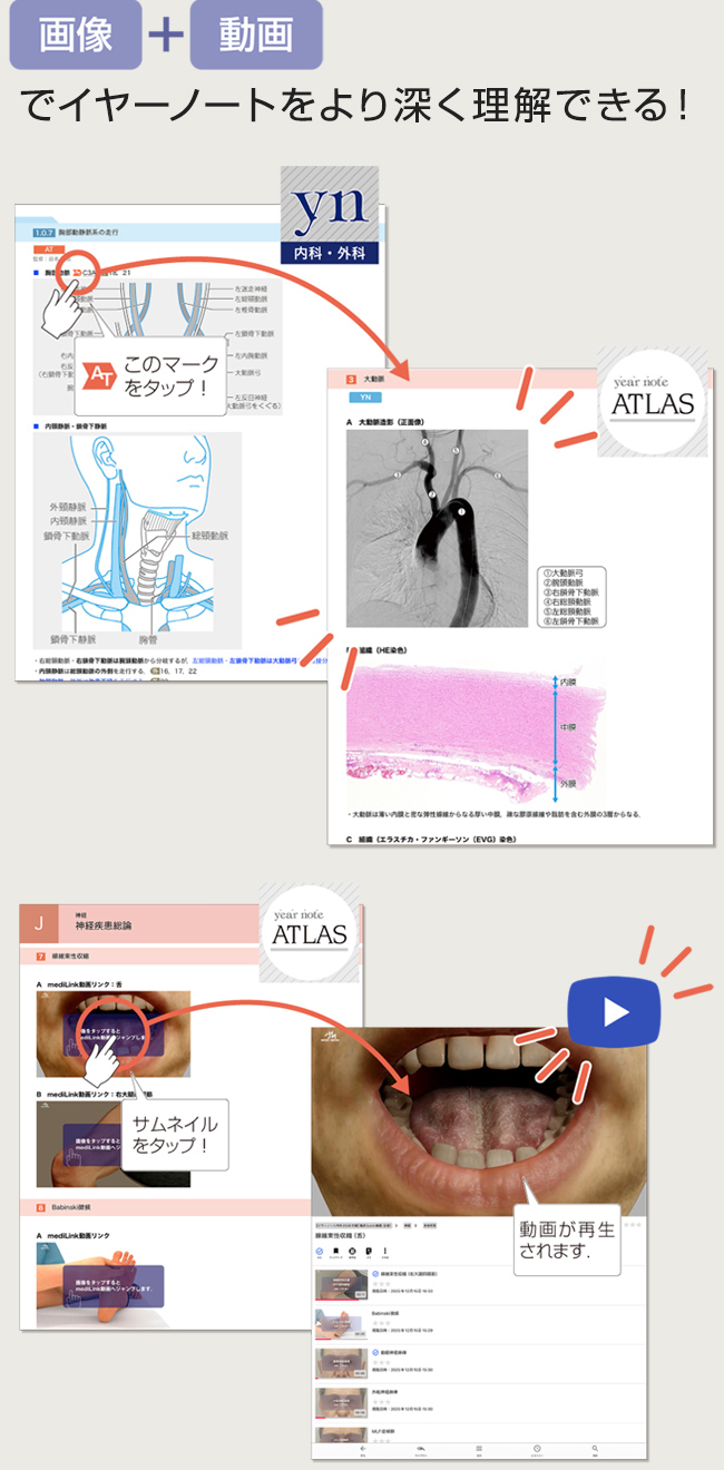 画像+動画でイヤーノートをより深く理解できる！